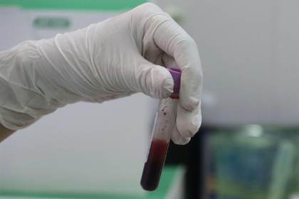 Un nuevo método avanza hacia la detección del cáncer con un análisis de sangre
