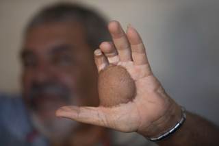 Los sobrevivientes del accidente radiactivo de Goiania: “Hay discriminación hasta hoy”