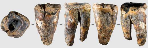 Los neandertales trataban caries usando herramientas de piedra hace 60.000 años