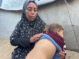 "Alérgicos a nuestra propia ropa": el calor dispara las plagas en los campamentos de Gaza