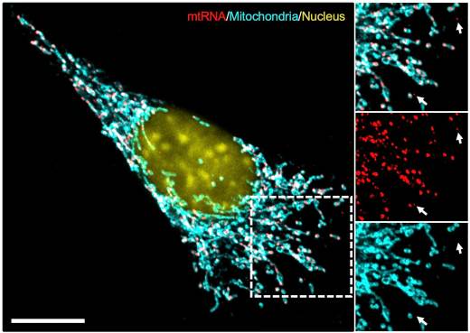 Desvelan el mecanismo que hace que el sistema inmunitario ayude al crecimiento de un tumor