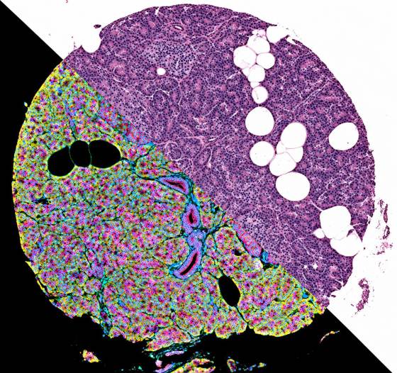 Un atlas celular del páncreas revela cómo el órgano se adapta a las enfermedades