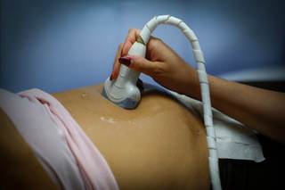 Un mecanismo genético en la formación de la placenta explica complicaciones en el embarazo