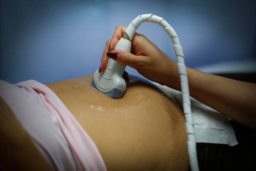 Un mecanismo genético en la formación de la placenta explica complicaciones en el embarazo