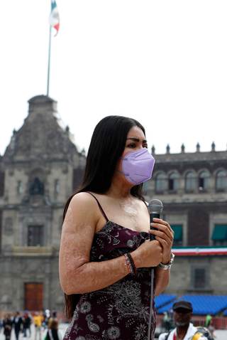 Exdiputado acusado de ataque con ácido en México pide a Supremo devolver caso a Oaxaca