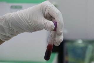 Un nuevo método avanza hacia la detección del cáncer con un análisis de sangre