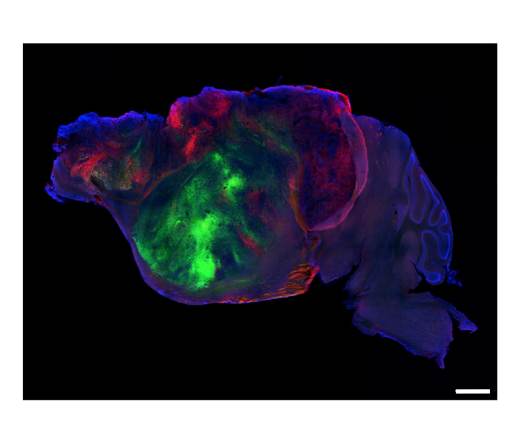 Cultivan tejido cerebral humano en modelos de ratón para el futuro estudio de enfermedades