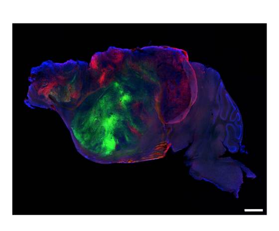 Cultivan tejido cerebral humano en modelos de ratón para el futuro estudio de enfermedades