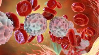 Cansancio, infecciones y moretones: señales de alerta sobre enfermedades hematológicas