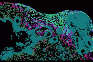 La ciencia descifra cómo se va extendiendo el herpes por la piel