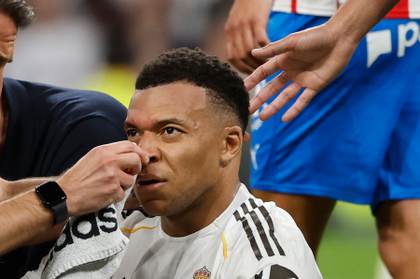 Mbappé regresa a los entrenamientos con un apósito en la ceja