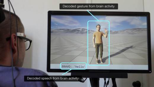 Una neuroprótesis para la parálisis permite a los pacientes comunicar palabras y gestos