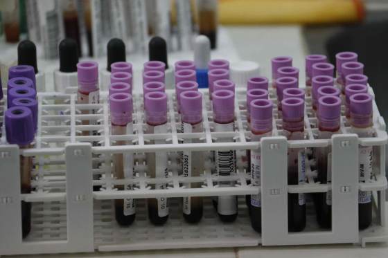 IA y el aprendizaje automático ayudarían a detectar a personas en riesgo de sufrir cáncer