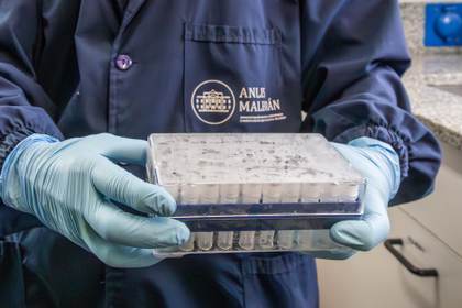 Argentina envía a países de África y Europa insumos para diagnosticar hantavirus