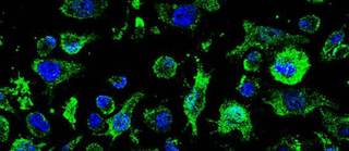 La Agencia del Medicamento autoriza un ensayo con un fármaco clínico contra la ELA