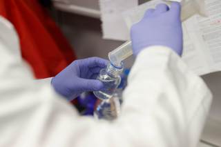 Decodifican el líquido cefalorraquídeo para entender la evolución de los tumores