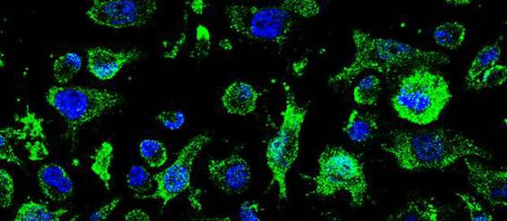 La Agencia del Medicamento autoriza un ensayo con un fármaco clínico contra la ELA
