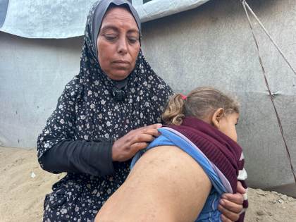 "Alérgicos a nuestra propia ropa": el calor dispara las plagas en los campamentos de Gaza